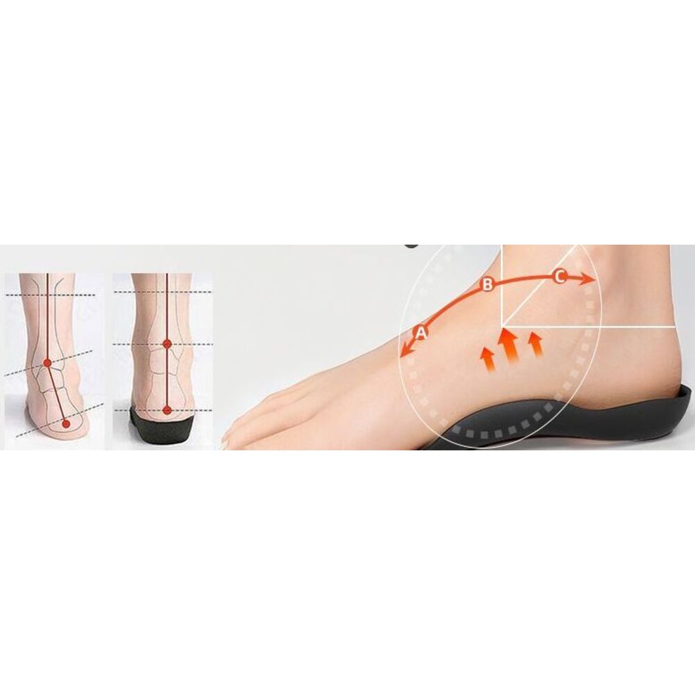 Corrective For Flat Feet, X/O-shaped Legs, Inversion And Eversion, Straight Leg Exercise Tool, Orthopedic Foot Arch_voghion.com