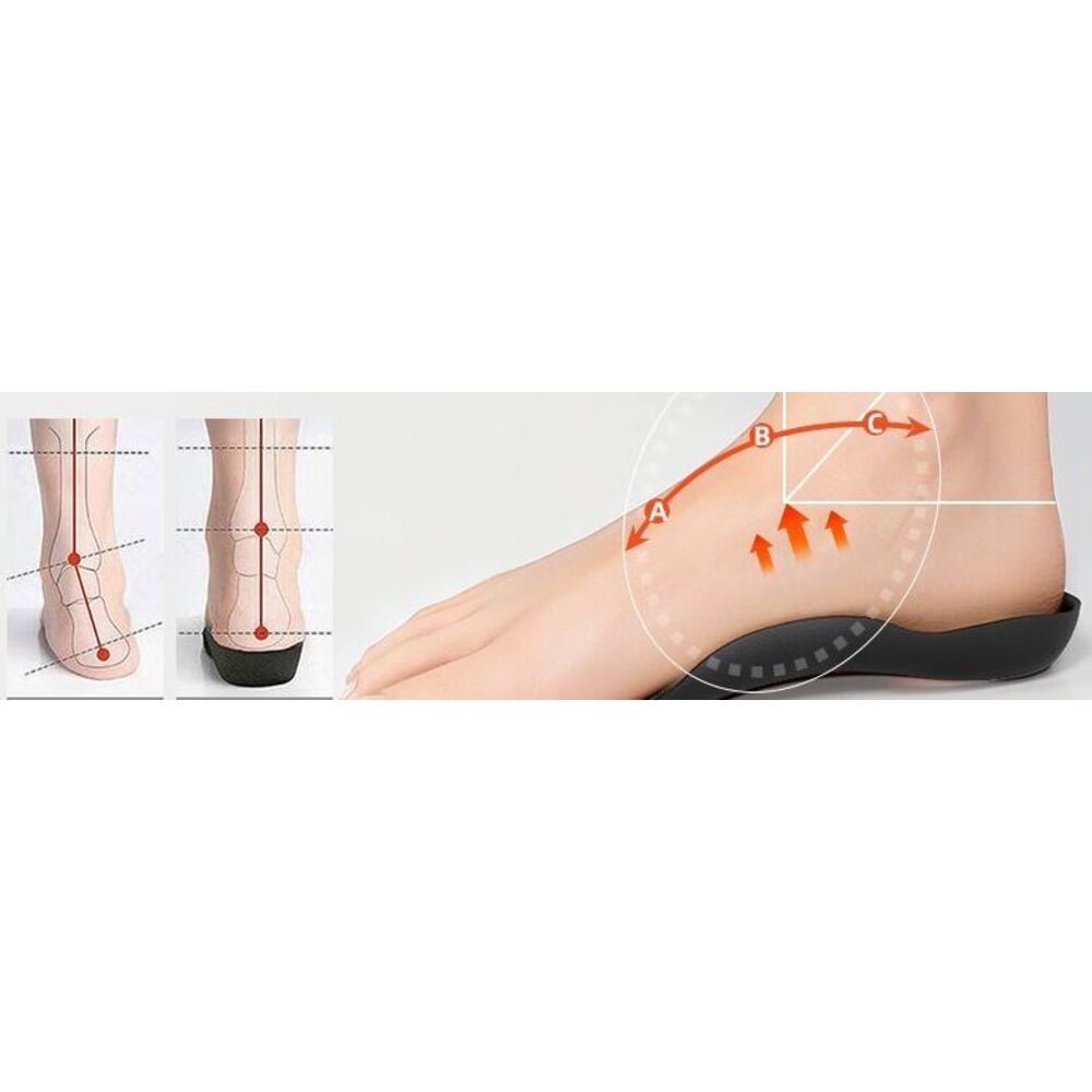 Corrective For Flat Feet, X/O-shaped Legs, Inversion And Eversion, Straight Leg Exercise Tool, Orthopedic Foot Arch_voghion.com